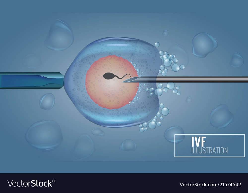 Sperm bank home insemination