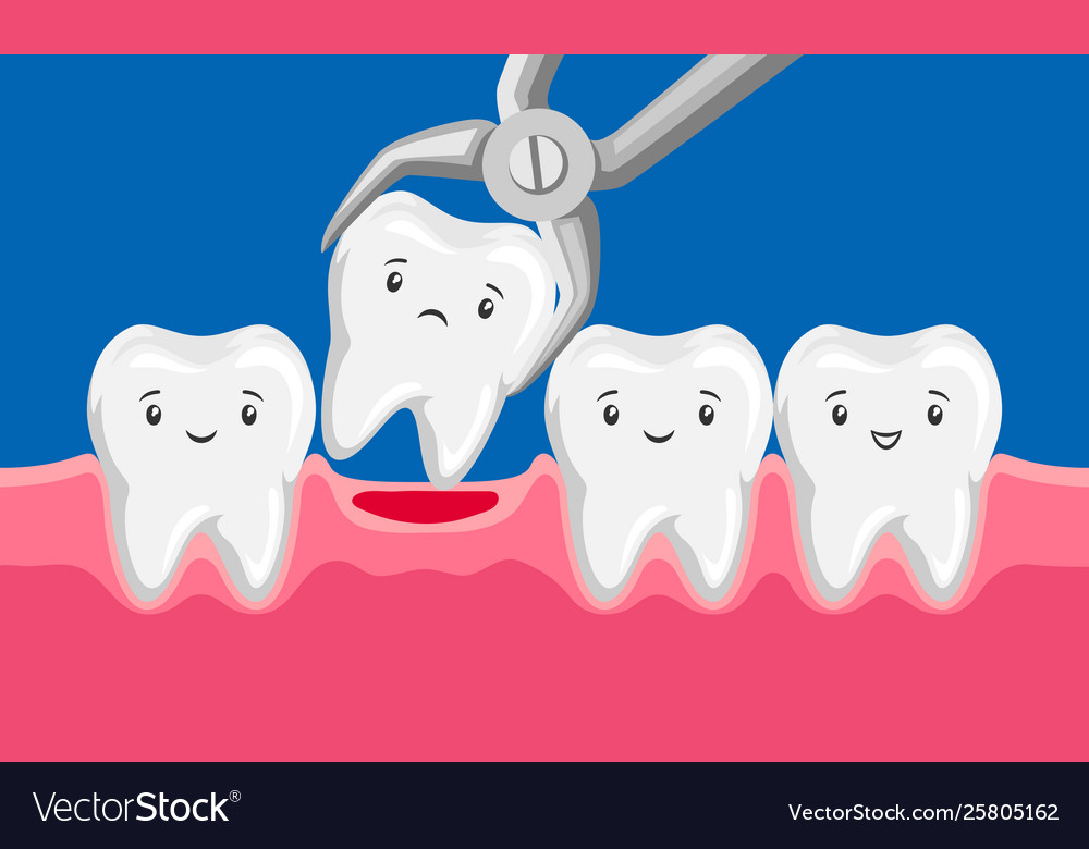 Tooth Is Removed Forceps In Oral Royalty Free Vector Image