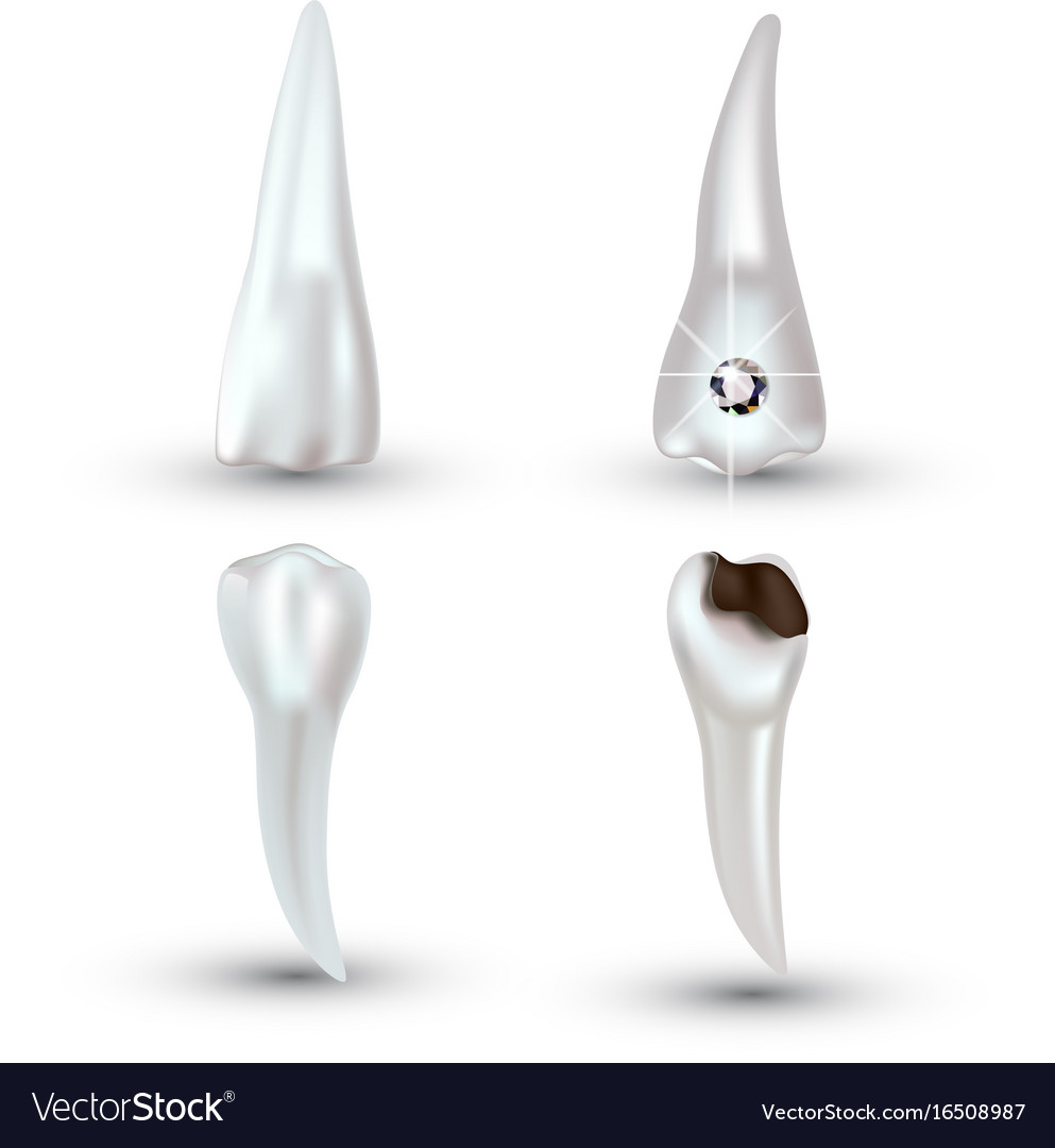 Set Of D Realistic Clean And Dirty Tooth Vector Image