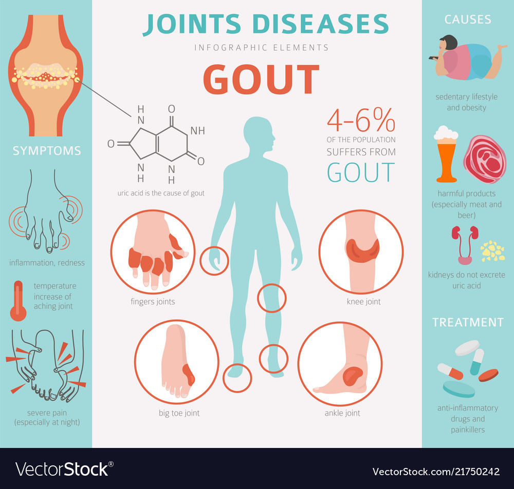 Joints diseases gout symptoms treatment icon set vector image