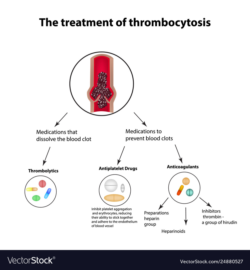 Treatment thrombocytosis embolism Royalty Free Vector Image