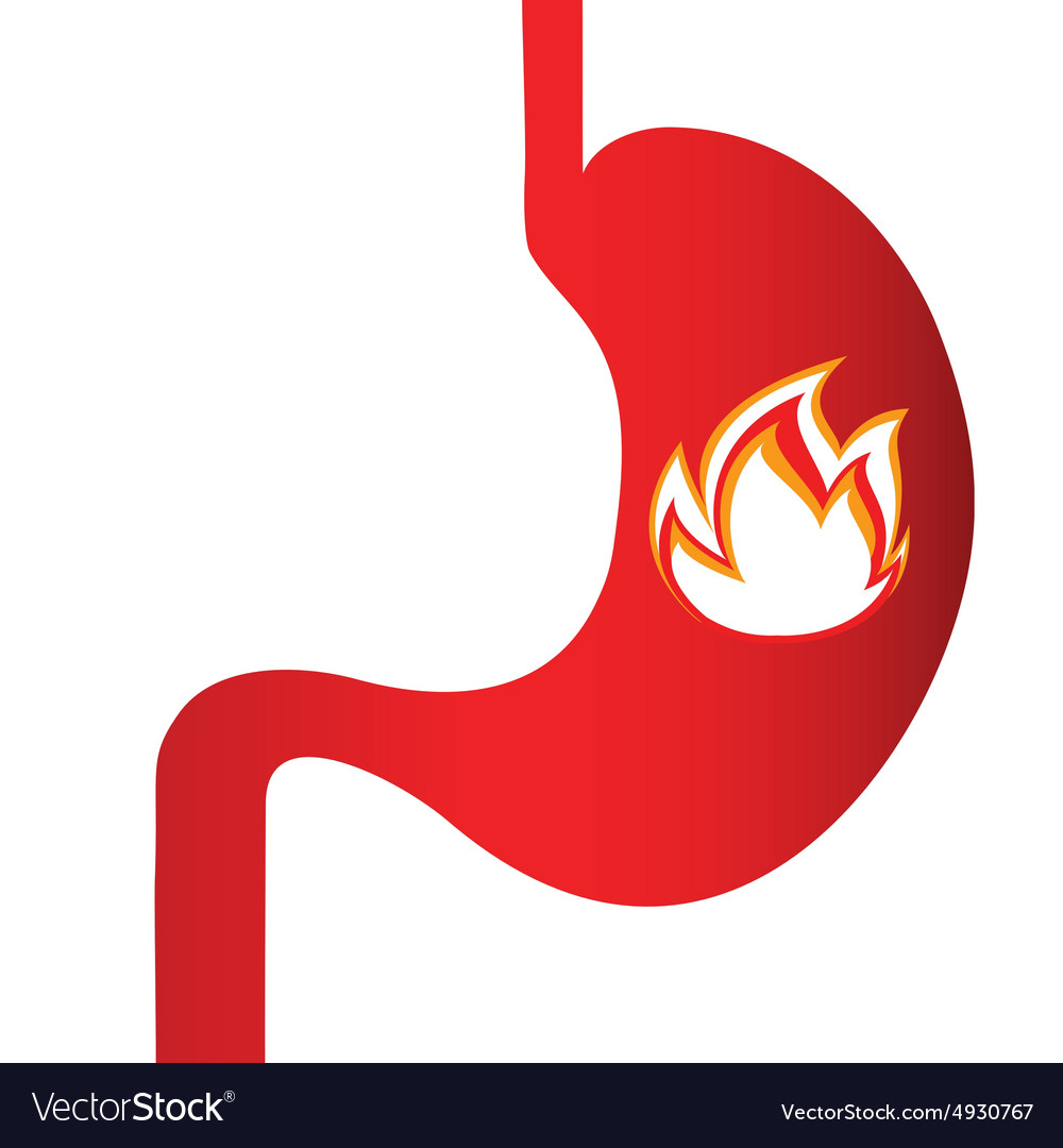 burning-sensation-in-the-stomach-royalty-free-vector-image