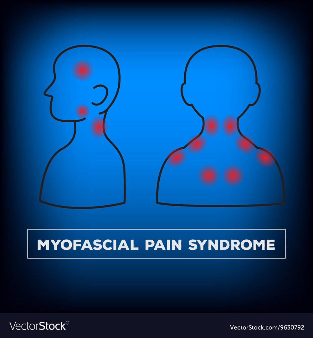 Neck pain Royalty Free Vector Image - VectorStock