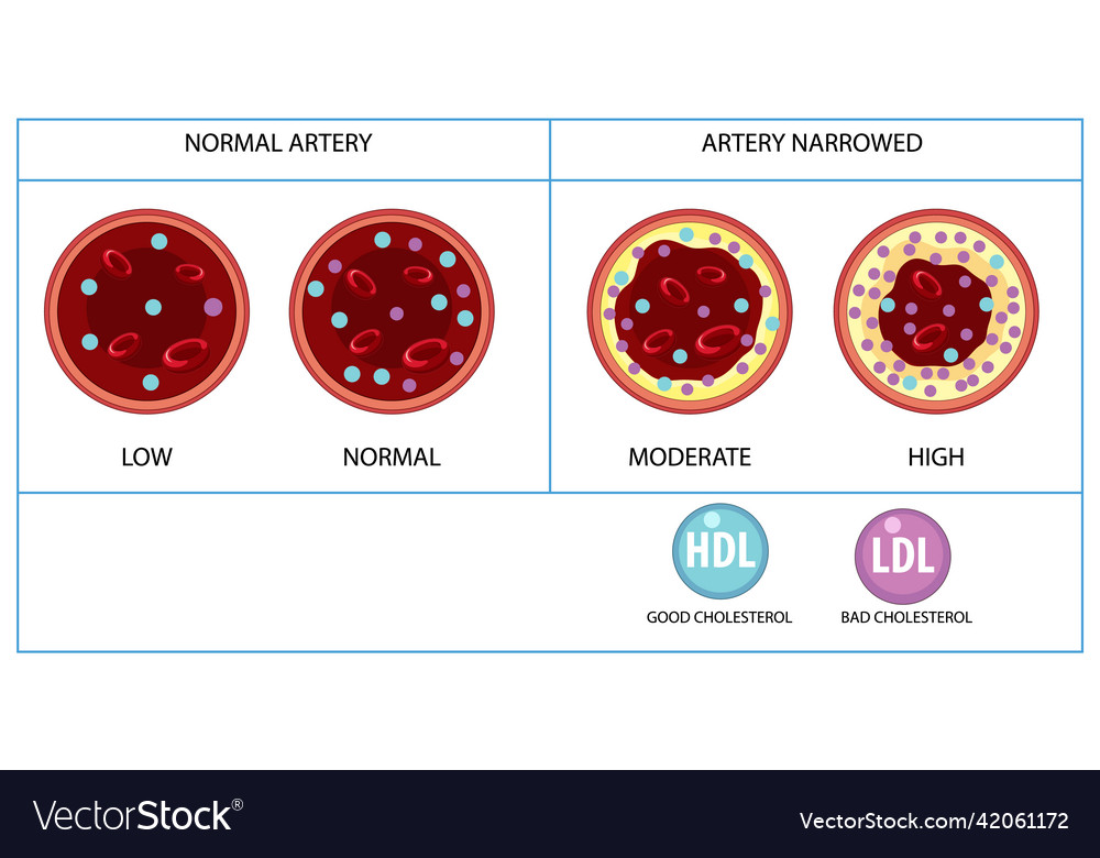 Types of cholesterol hdl and ldl Royalty Free Vector Image