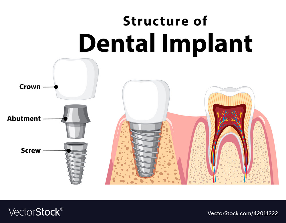 Infographic of human in structure the dental Vector Image