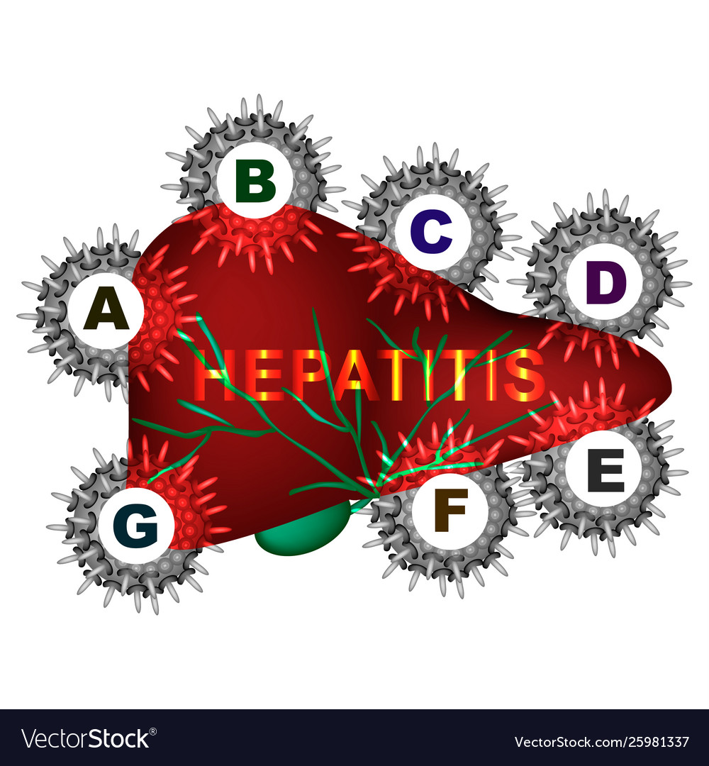 Types Viral Hepatitis Hepatitis A B C D E Vector Image