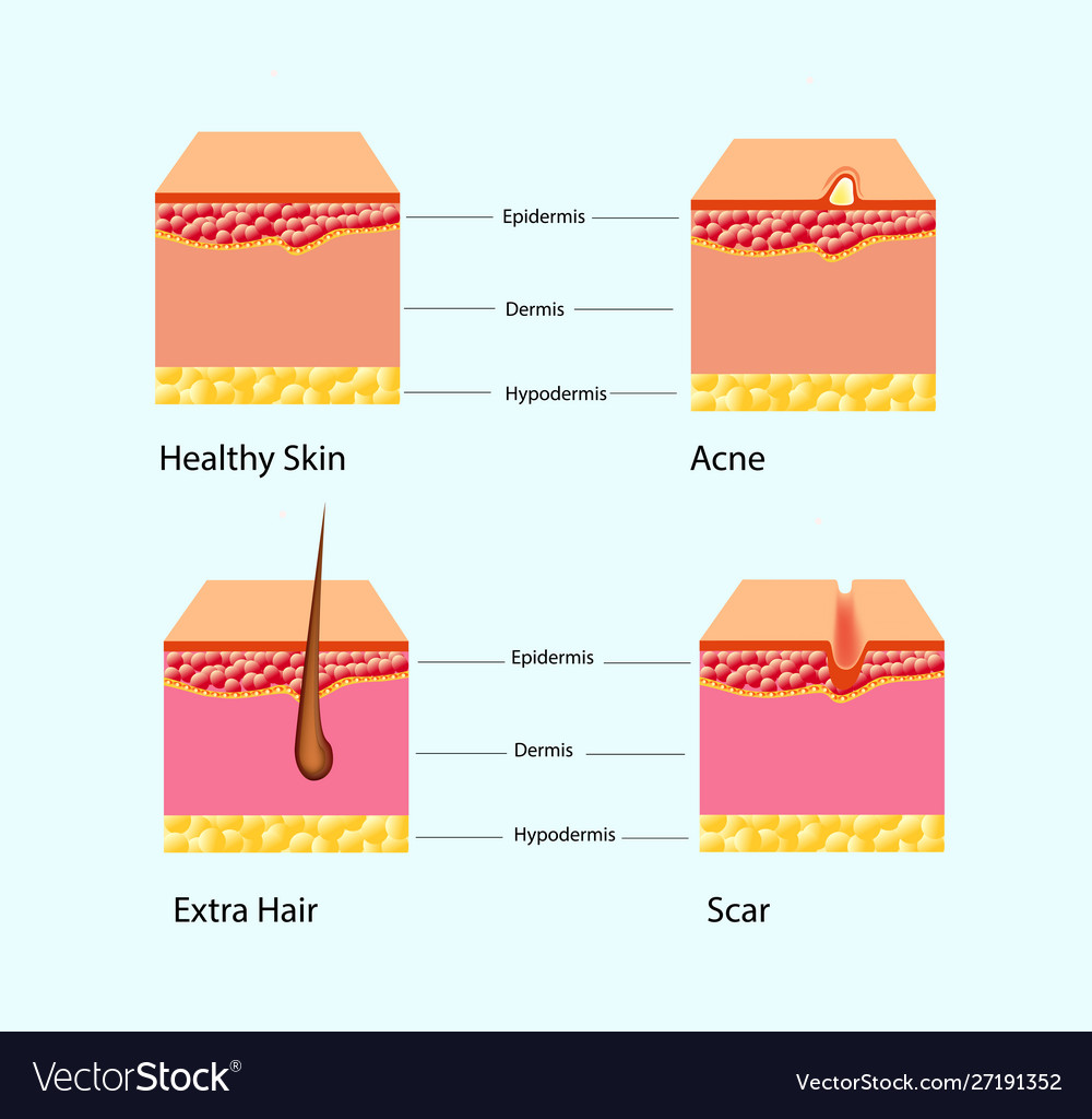 Types Skin Problems Royalty Free Vector Image - Vectorstock