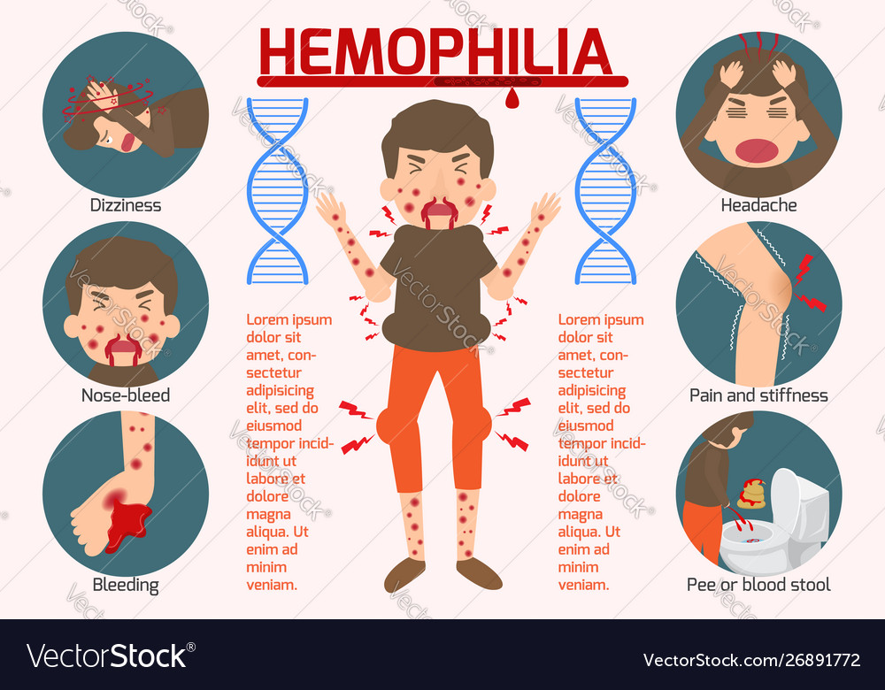 hemophilia-symptom-infographics-elements-sign-and-vector-image