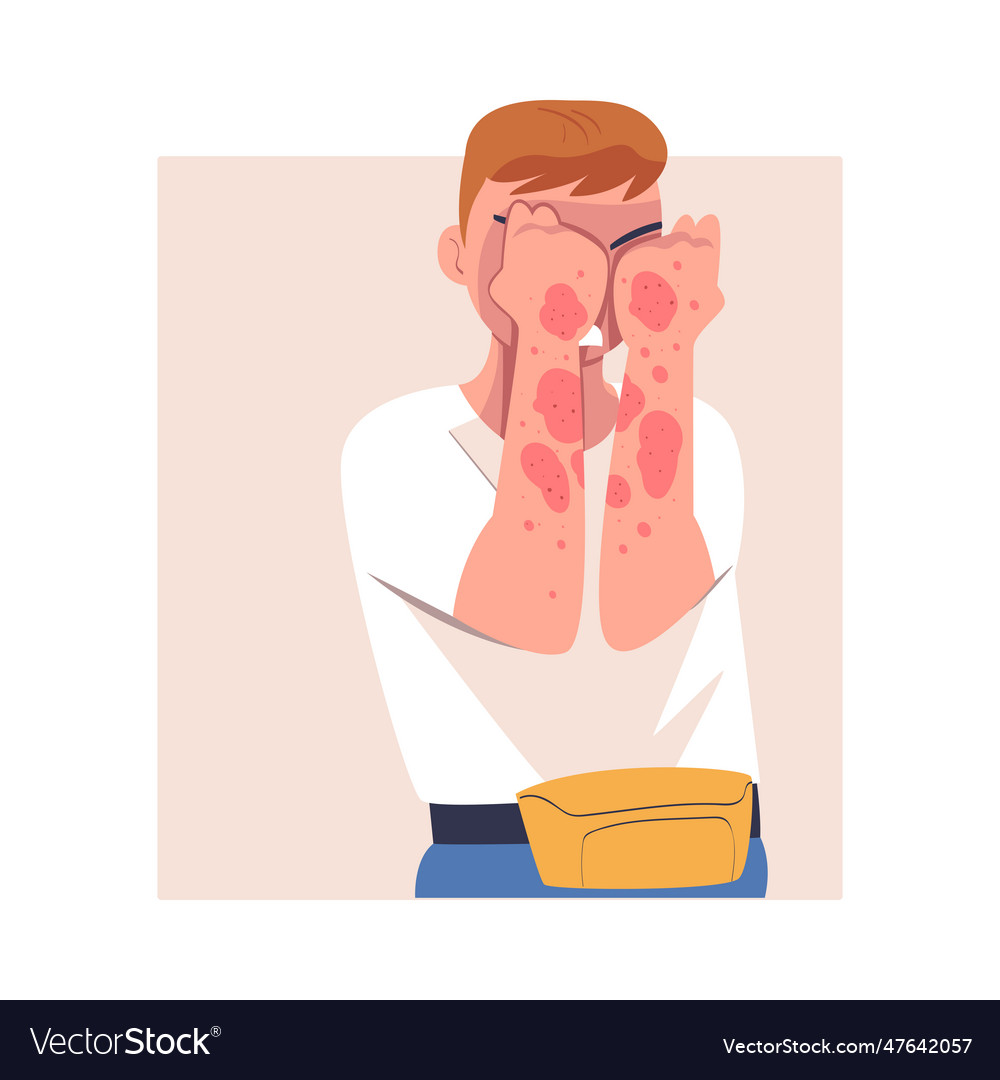 Man character with skin problem suffering from Vector Image