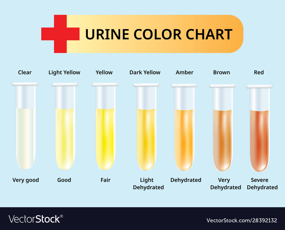 Urine Sample Colors