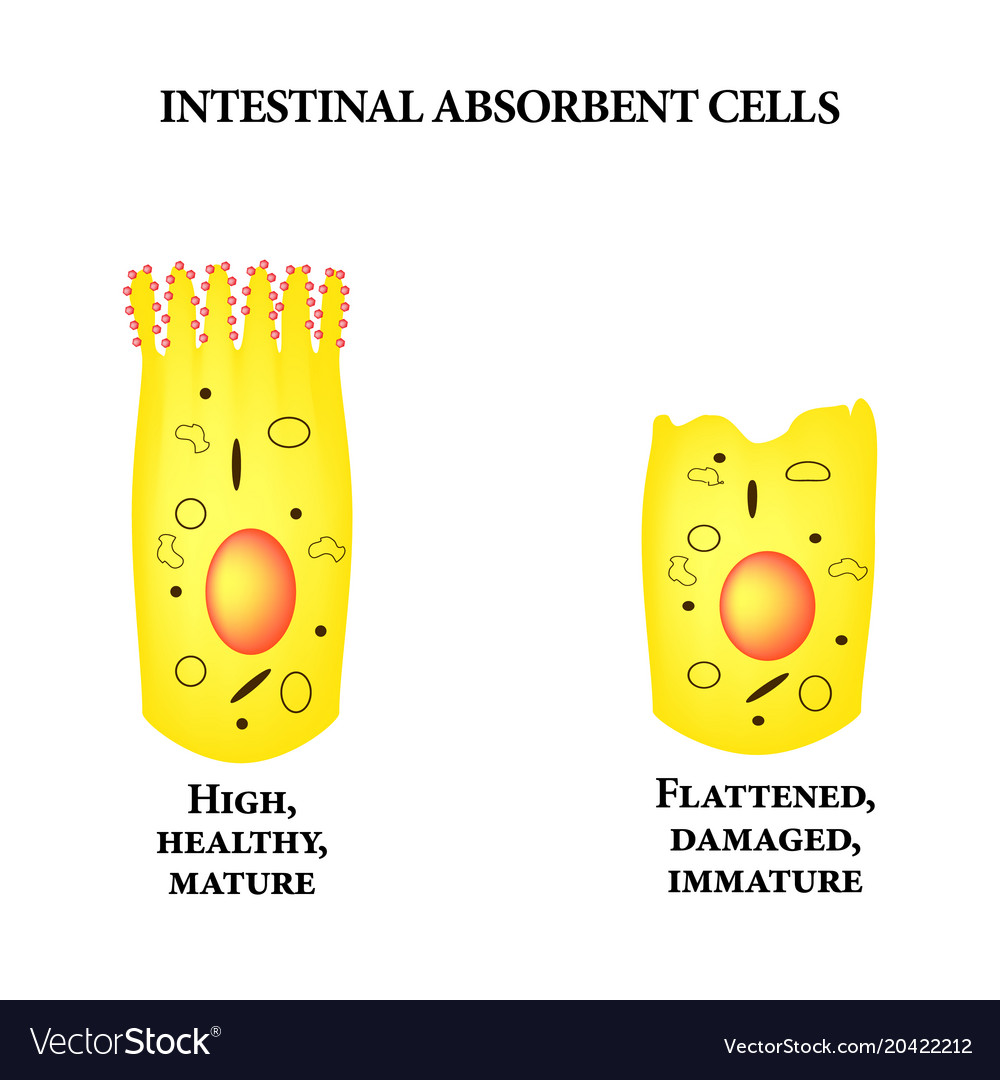 Structure of the enterocyte deformed sick cell Vector Image