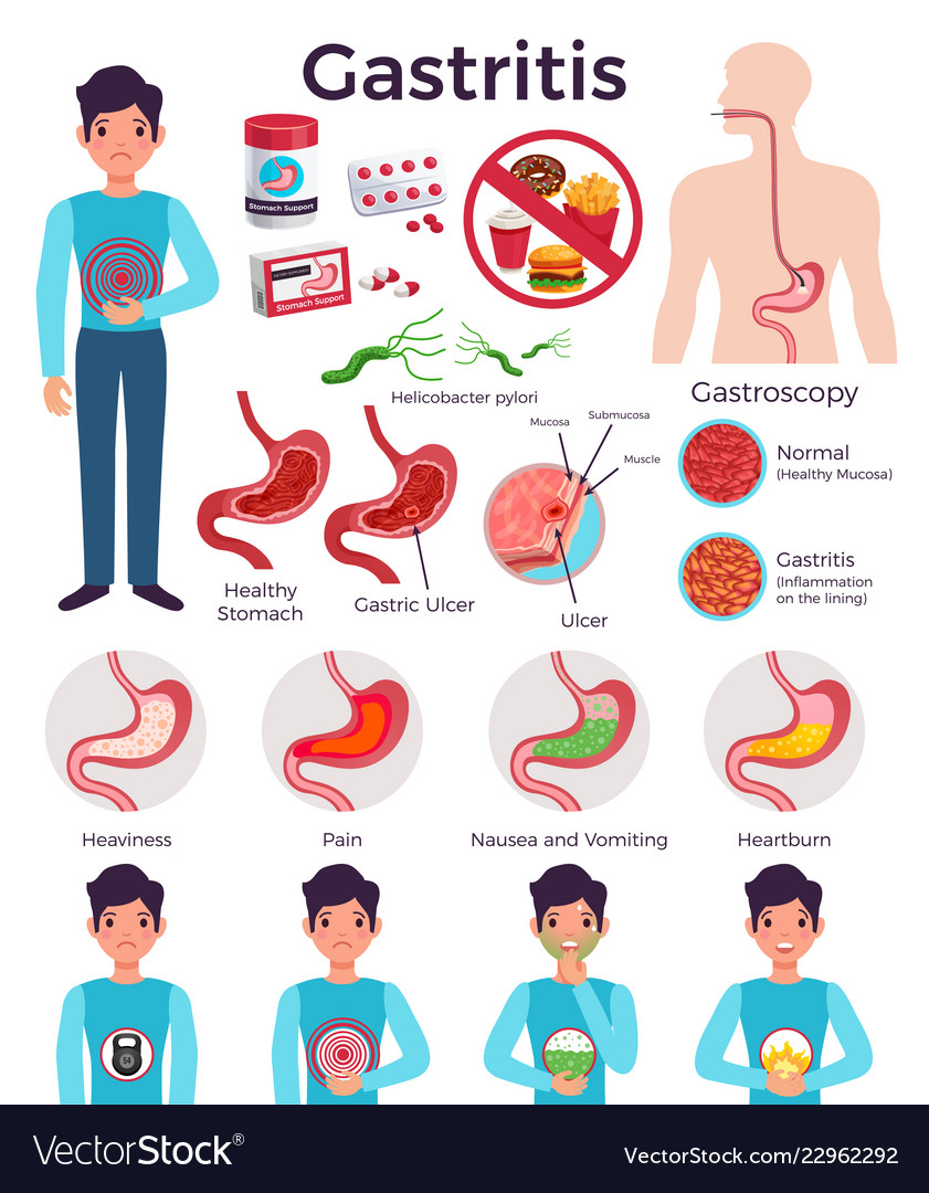 Gastritis infographic elements set Royalty Free Vector Image