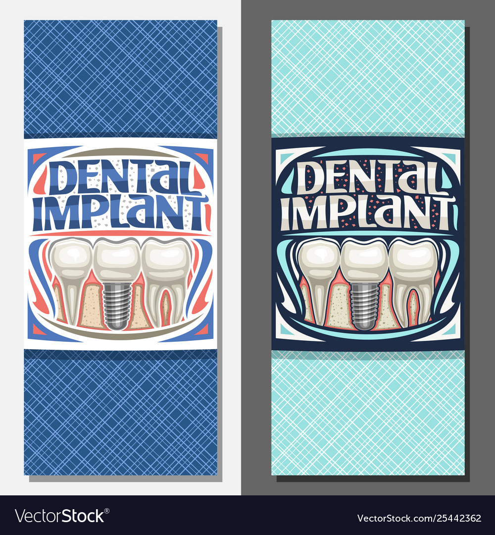 Banners for dental implant Royalty Free Vector Image