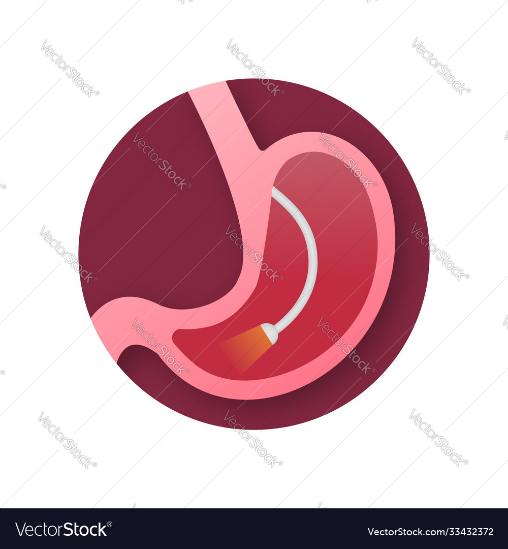 Stomach endoscopy endoscope in stomach through Vector Image