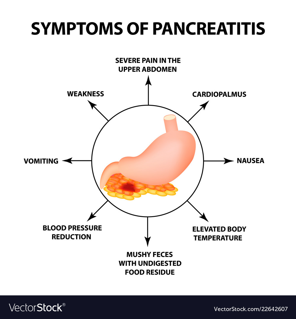 Symptoms pancreatitis structure the Royalty Free Vector