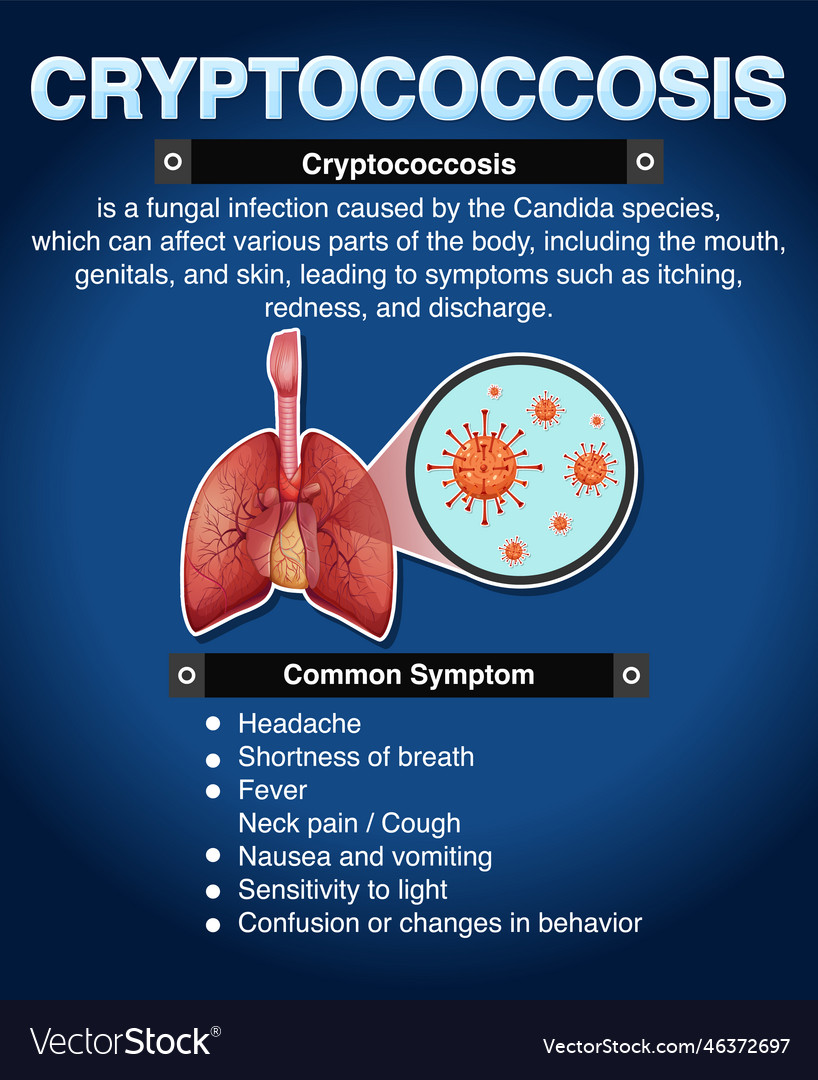 Informative poster of cryptococcosis Royalty Free Vector