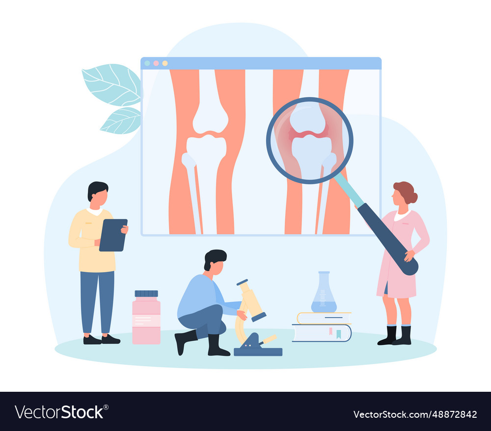 Degenerative cartilage disease in knee joint tiny Vector Image