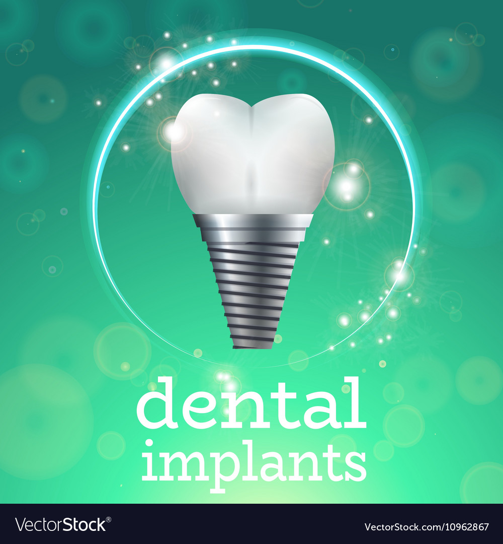 Dental implants 1