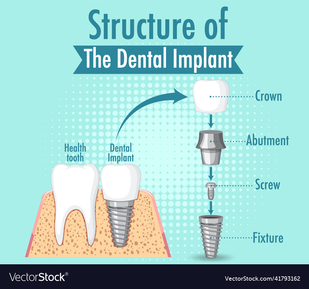 Infographic of human in structure the dental Vector Image