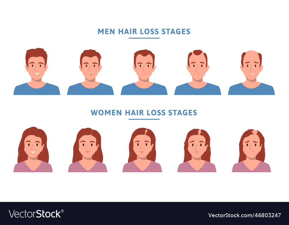 Hair loss alopecia people flat icon set Royalty Free Vector