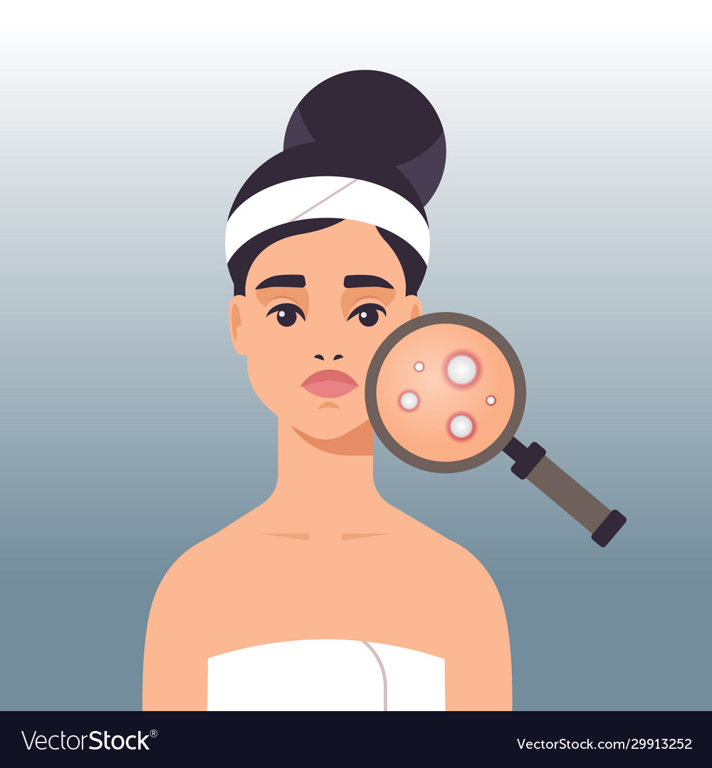 Woman Having Facial Skin Problems Girl Using Vector Image