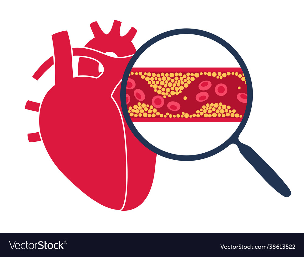 Cholesterol Heart Disease Royalty Free Vector Image Cholesterol Heart Disease Royalty Free Vector Image