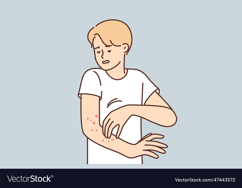 Man with rash on arm suffers from itching Vector Image