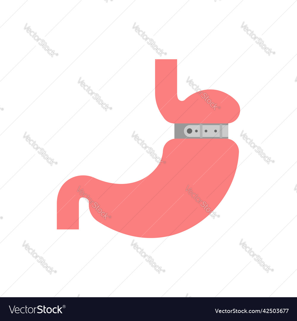 Stomach banding isolated adjustable gastric band