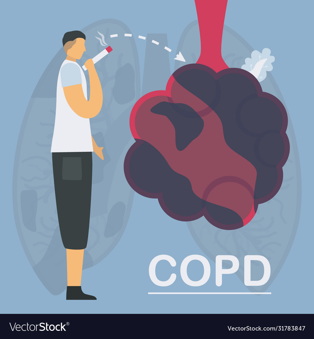 Smoking is cause chronic obstructive pulmonary Vector Image