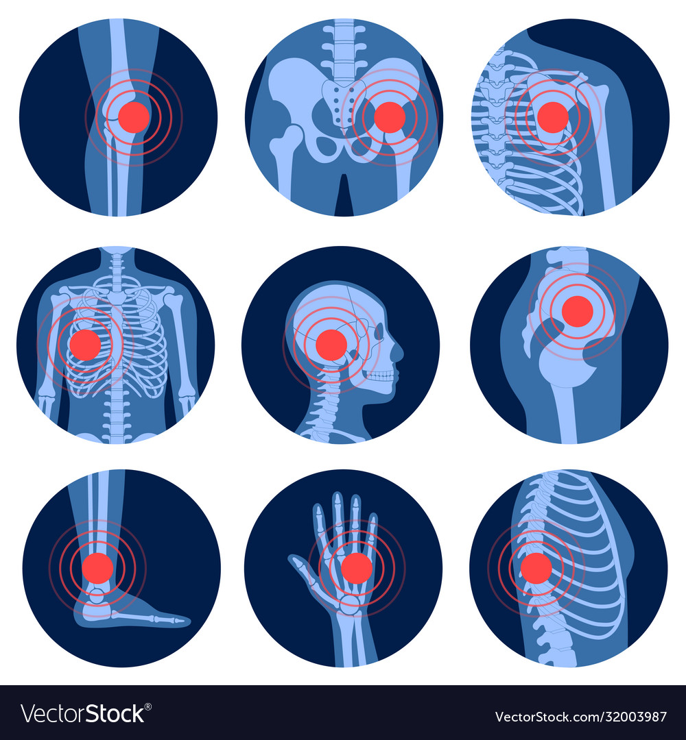 Skeleton x ray