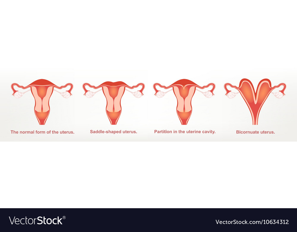 Shape of the uterus female reproductive Royalty Free Vector