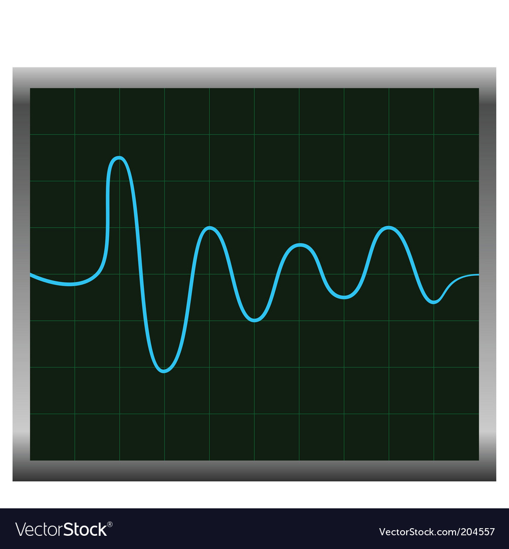 Electronic cardiogram