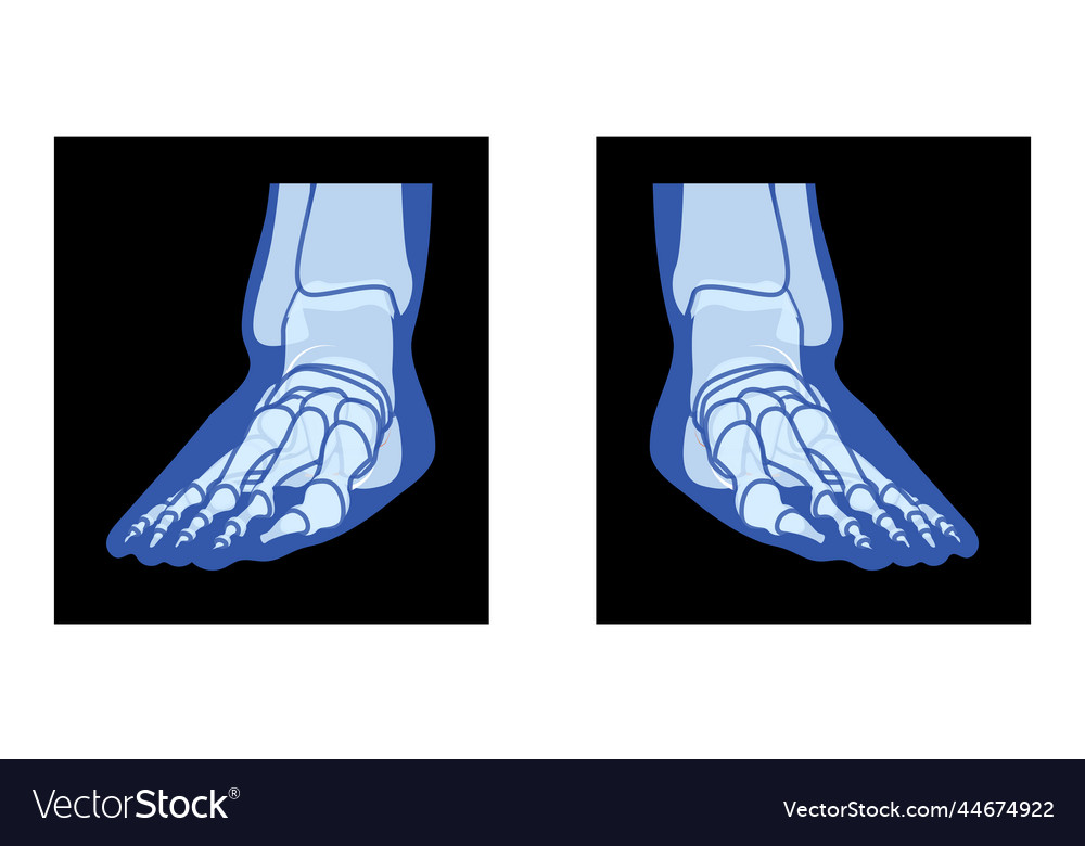 X-ray foot legs skeleton human body bones Vector Image