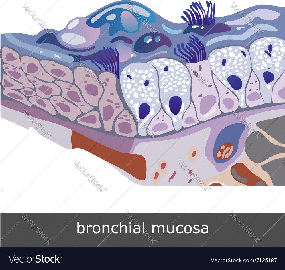 Geschädigte Bronchial Mucosa
