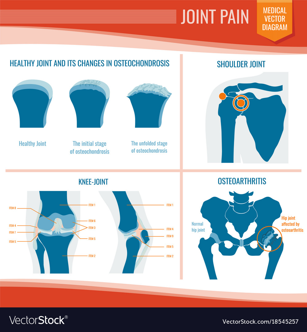 Osteoarthritis and rheumatism joint pain medical Vector Image