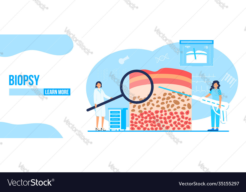 Biopsy patient concept oncologist Royalty Free Vector Image