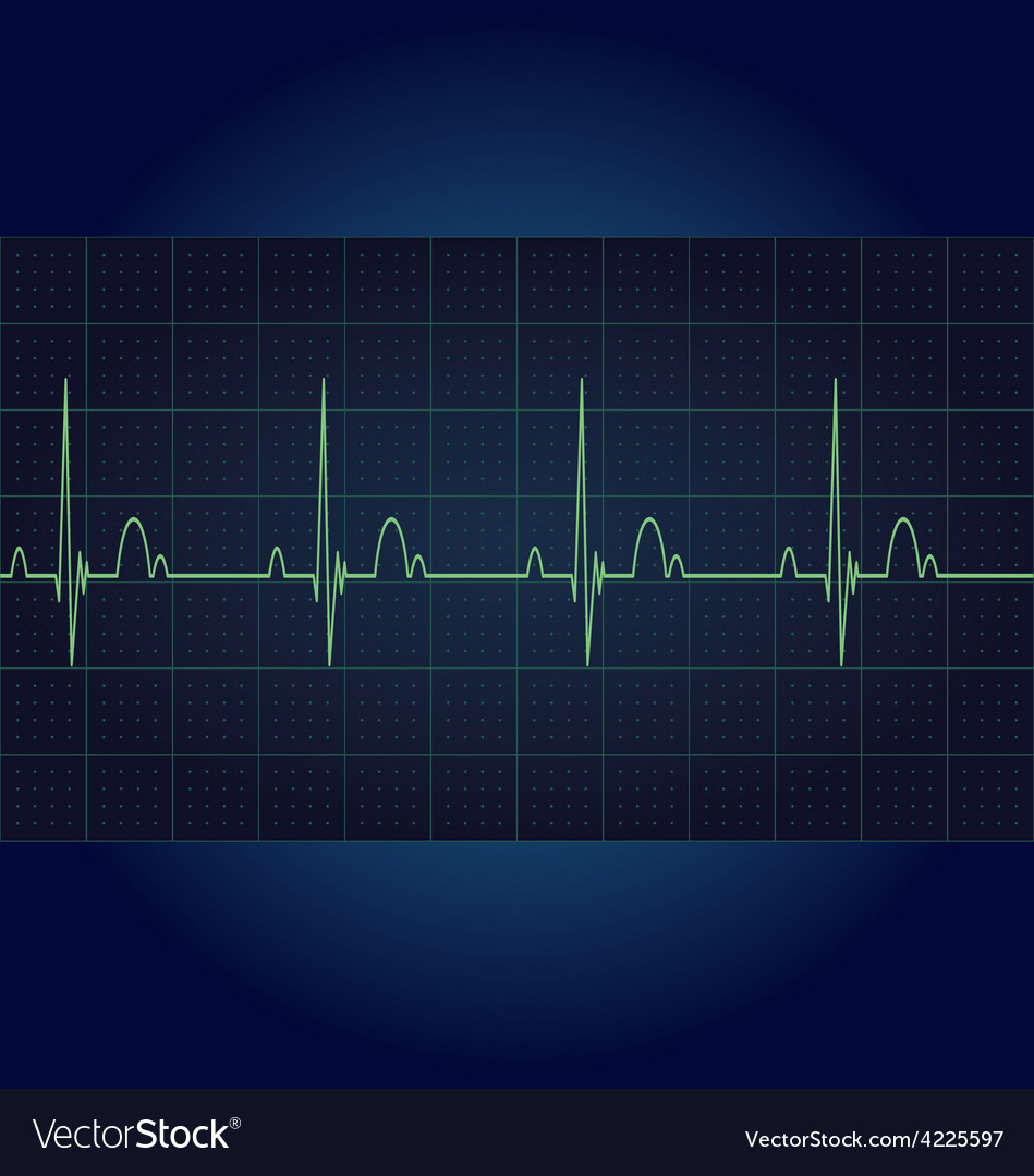 Ecg Zeichen
