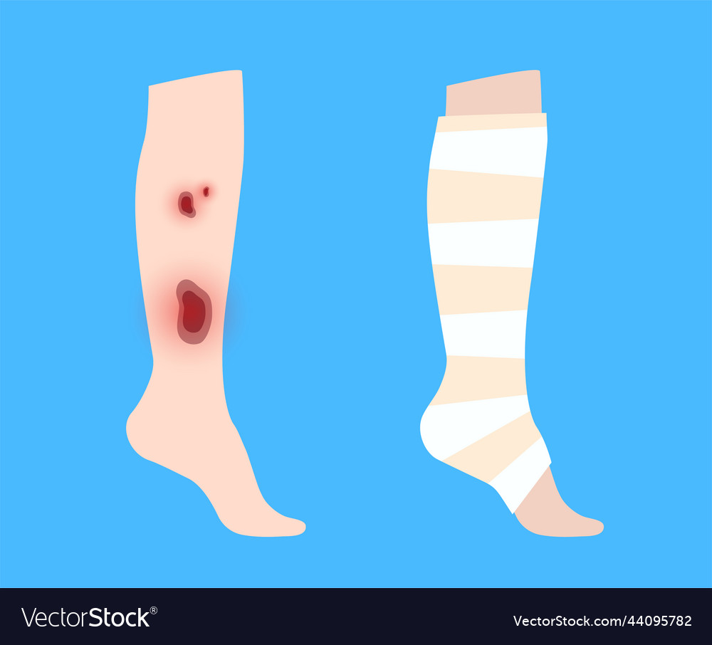 Leg bandage wrapping Royalty Free Vector Image