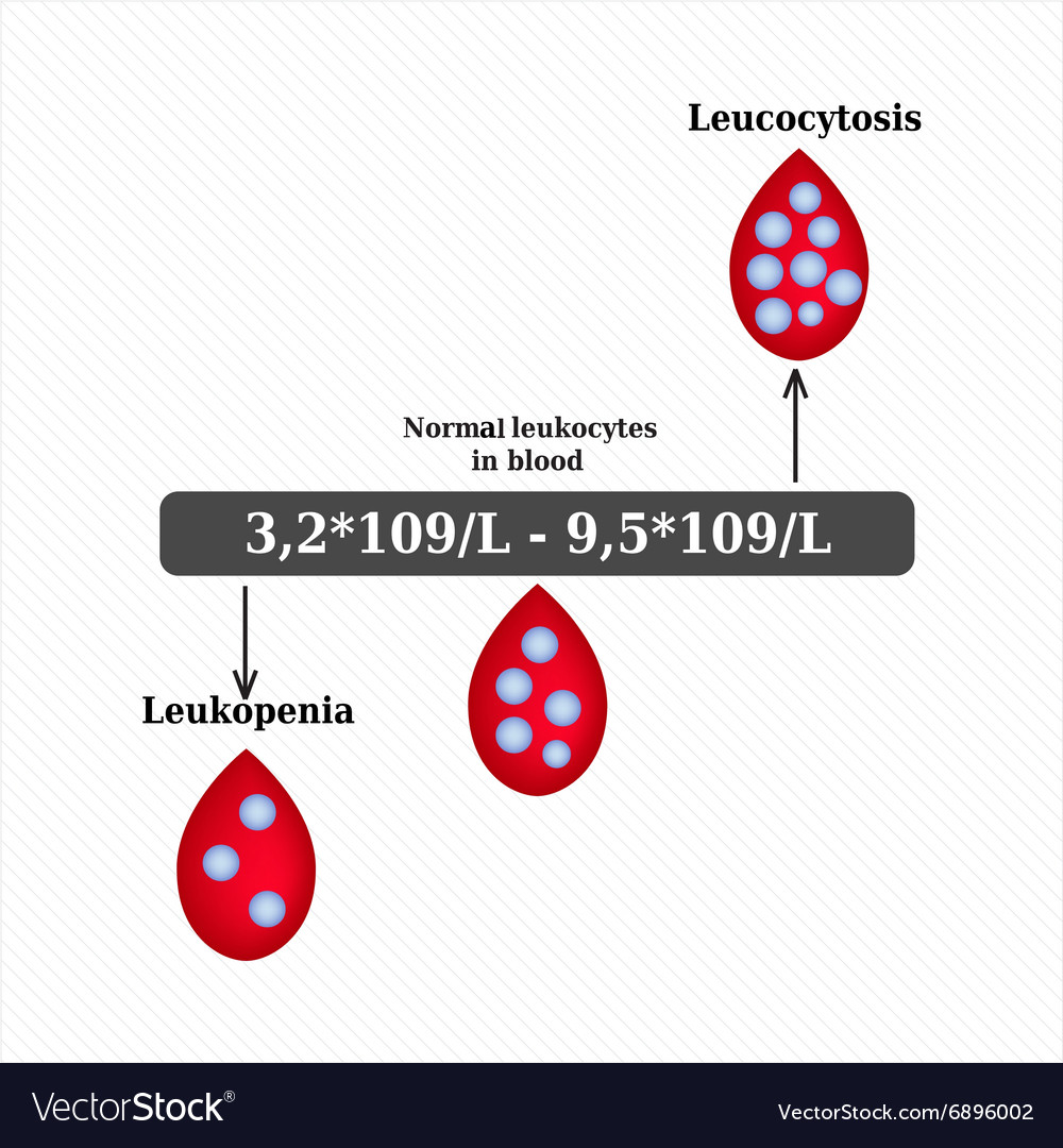 White blood cell count leukopenia leukocytosis Vector Image