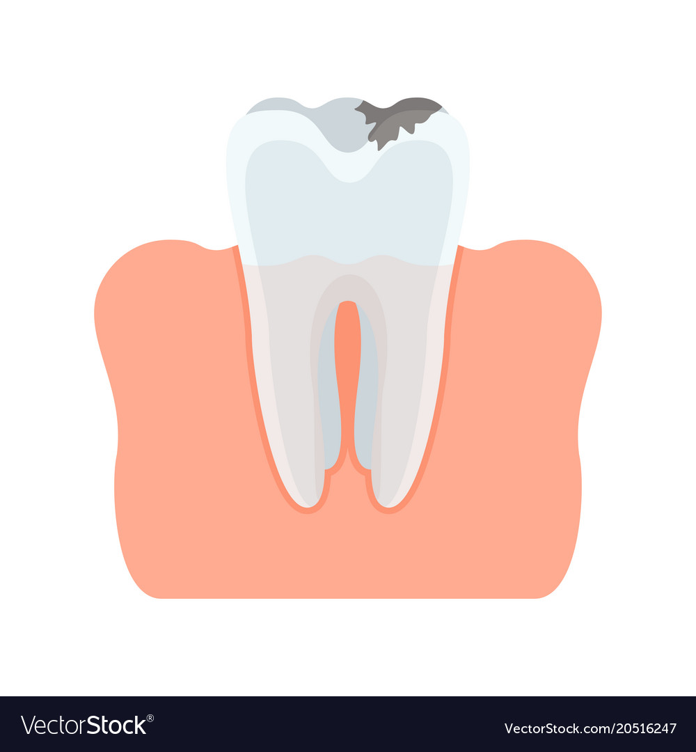 Tooth injured with caries