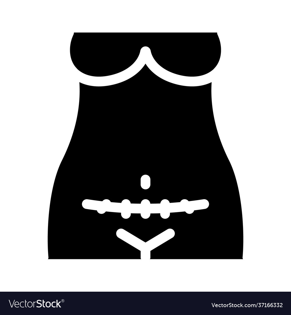 Cesarean section icon glyph Royalty Free Vector Image