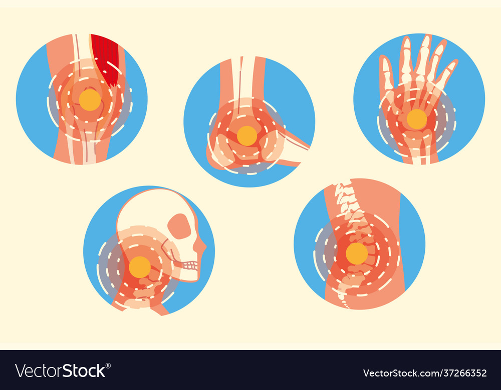 Arthritis joint pain Royalty Free Vector Image