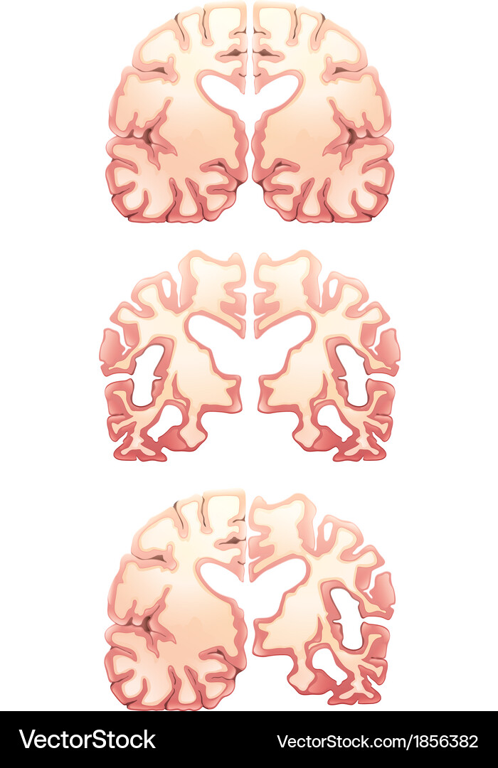 Human brain Royalty Free Vector Image - VectorStock