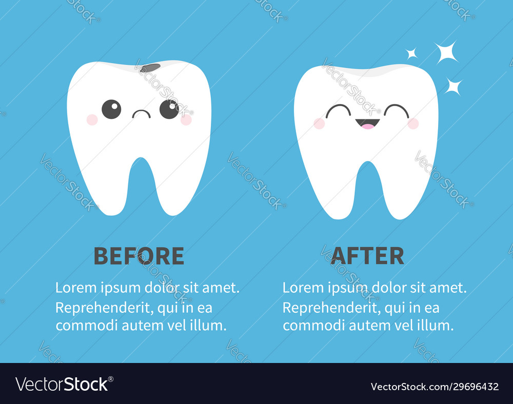 Tooth icon set before after infographic template