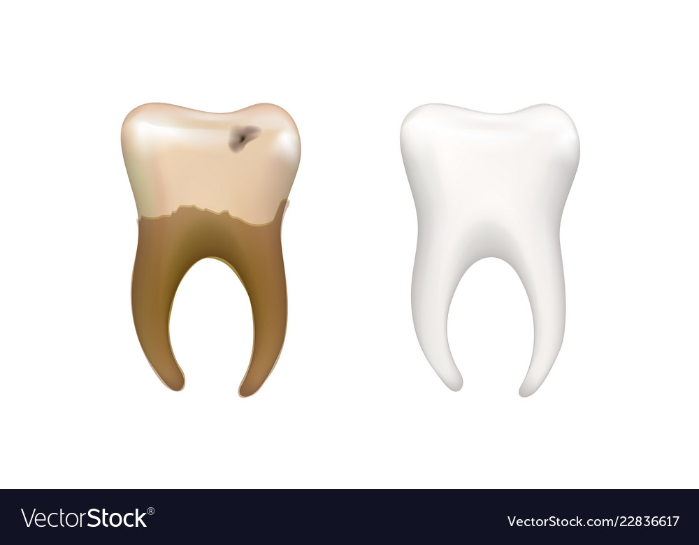 Healthy bright human tooth and old dirty