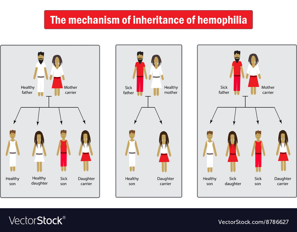 the-mechanism-inheritance-hemophilia-royalty-free-vector