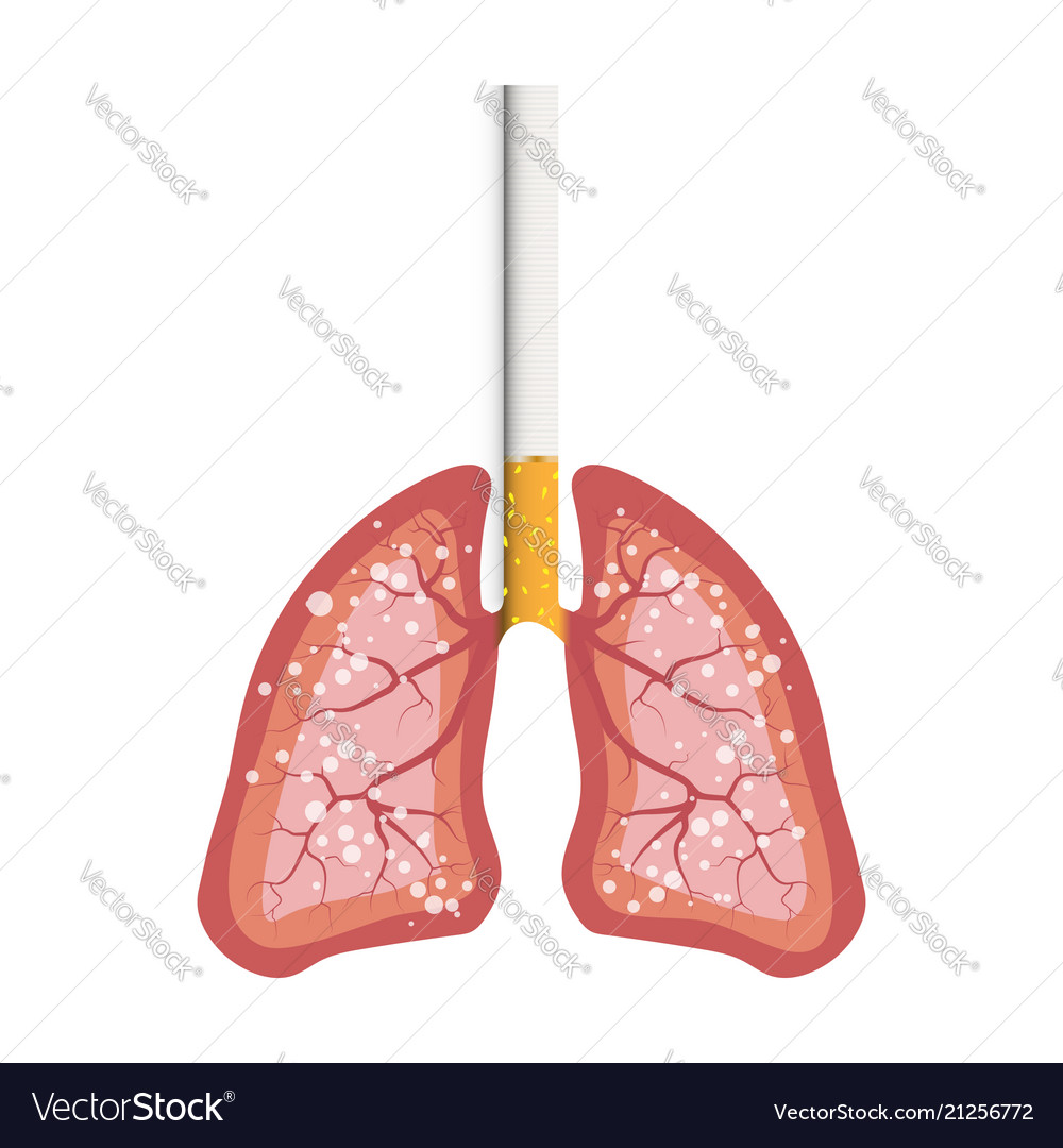 smokers lungs cancer from