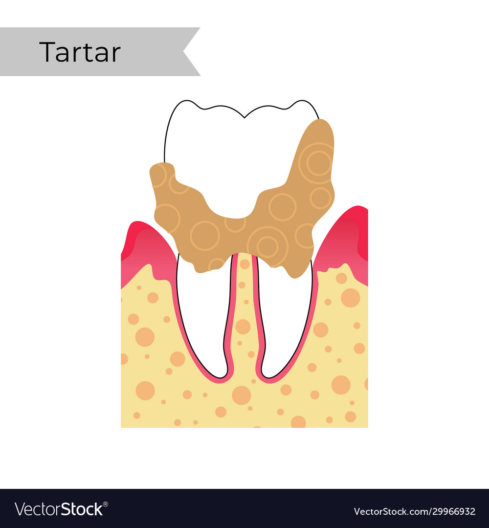 Isolated tooth