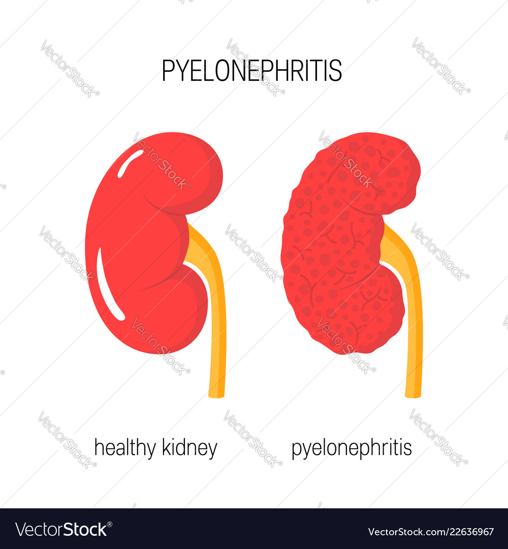 Healthy kidneys