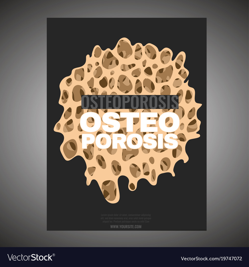 Osteoporosis Poster Template Royalty Free Vector Image